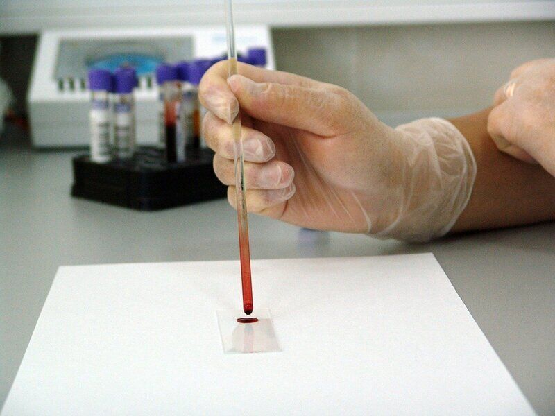 Una nuova analisi del sangue potrebbe rilevare oltre 50 tipi di cancro