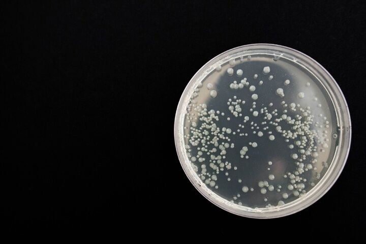 Le cellule staminali rivelano i pilastri di una rara malattia immunitaria