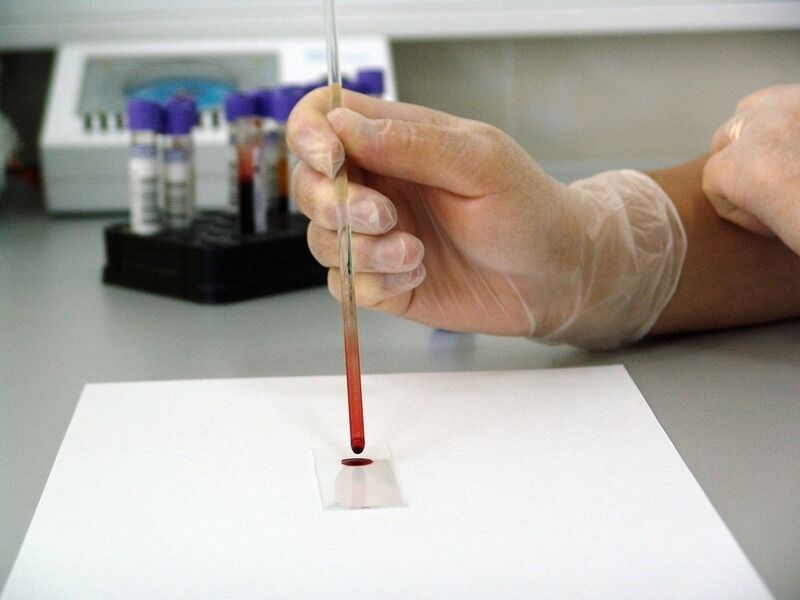 Interazioni proteina-proteina: una nuova frontiera per la biotecnologia