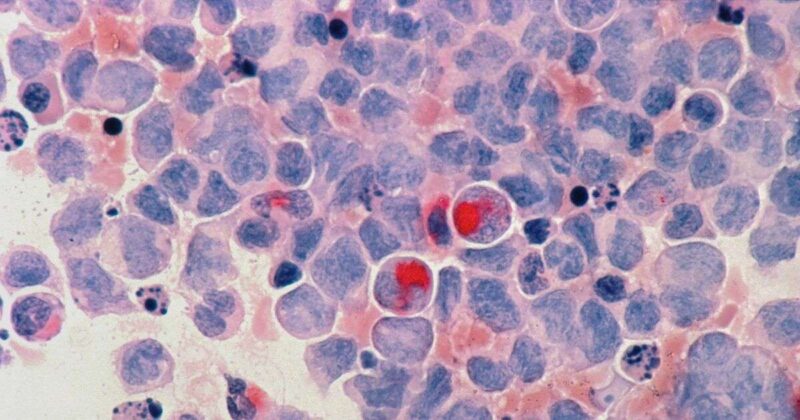 Cancro: un piccolo organo potrebbe aiutare a proteggerci