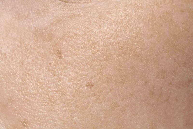 Inquinanti atmosferici interni: l’assorbimento cutaneo e i pericoli per la salute