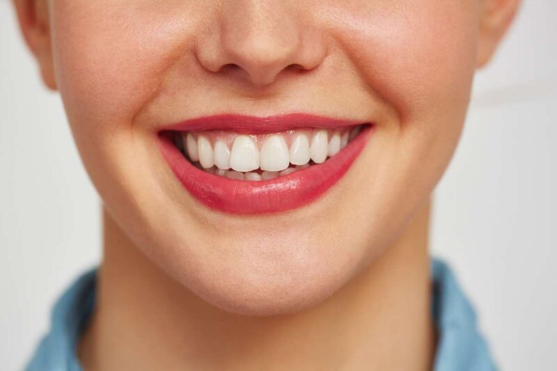 I cibi che macchiano di più i denti: come proteggere il nostro sorriso