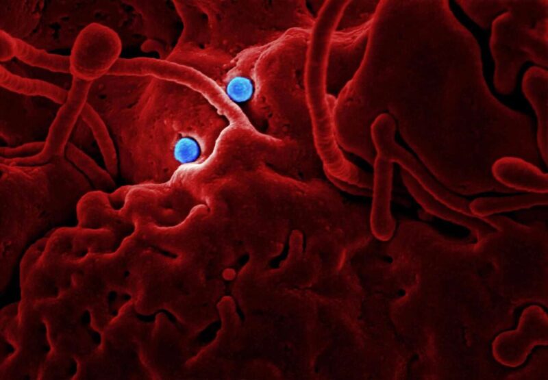 Affronta il Norovirus: Sintomi, Prevenzione e Cura