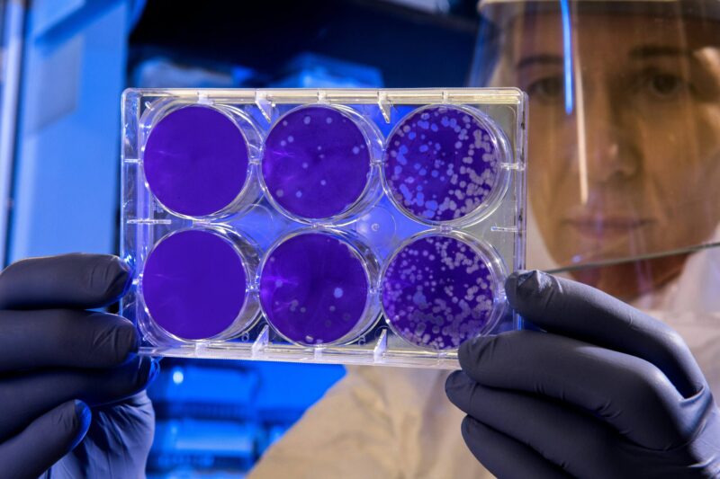 Vampirismo Batterico: I Batteri Mortali Attratti dal Sangue Umano