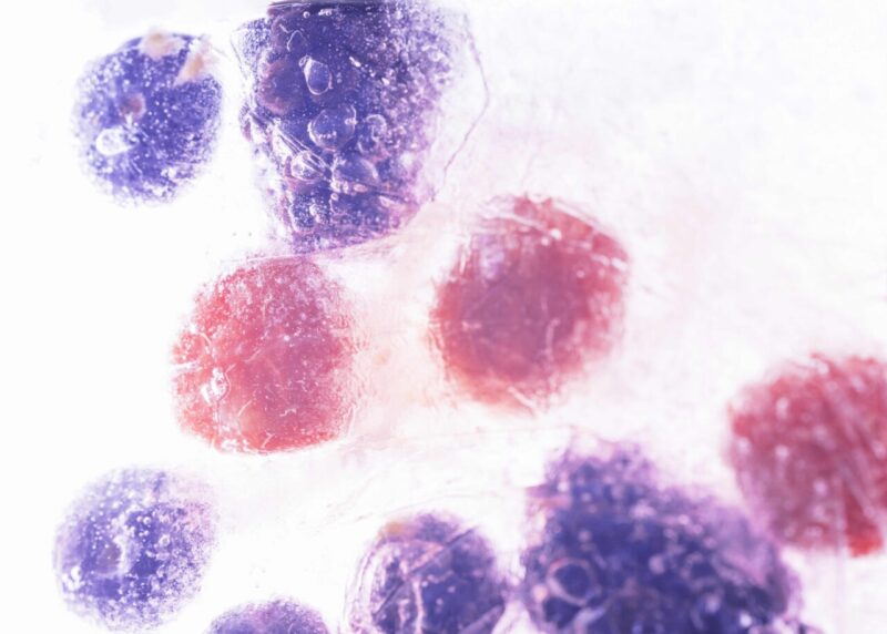 Rigenerazione muscolare, una nuova molecola potrebbe cambiare le cure contro la sarcopenia