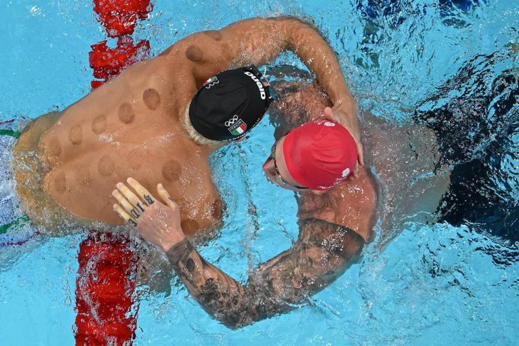 Cos’è la Coppettazione: Una Tecnica Antica che Conquista le Olimpiadi 2024