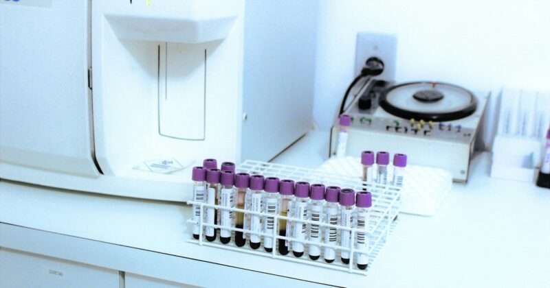 Cancro al cervello: un semplice esame del sangue