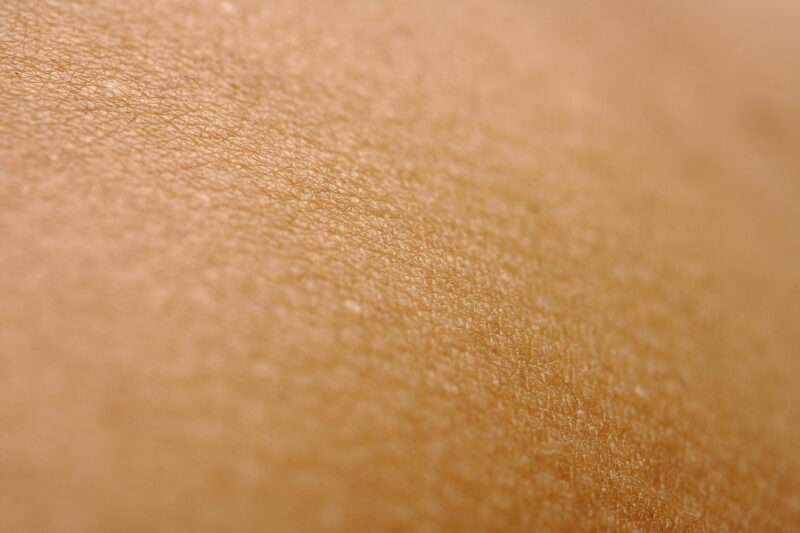 Pitiriasi rosea di Gibert: cause, sintomi e cure di una malattia della pelle
