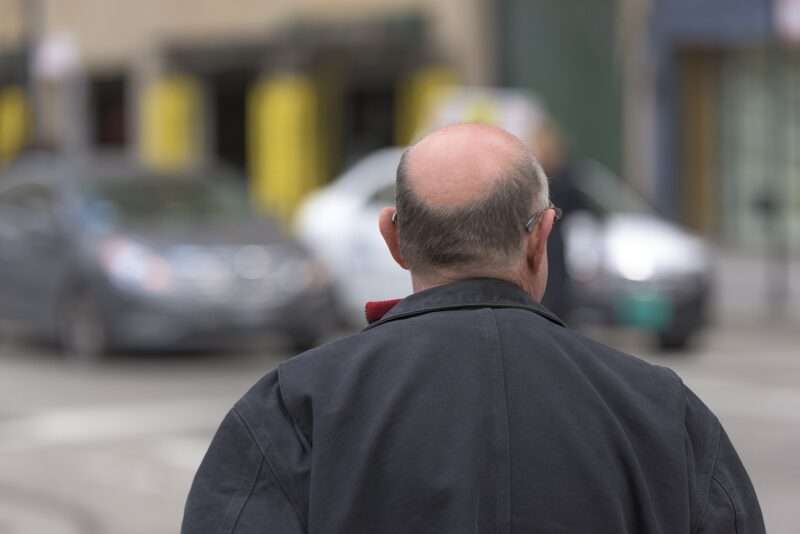 Digiuno intermittente e crescita dei capelli: benefici e possibili effetti collaterali