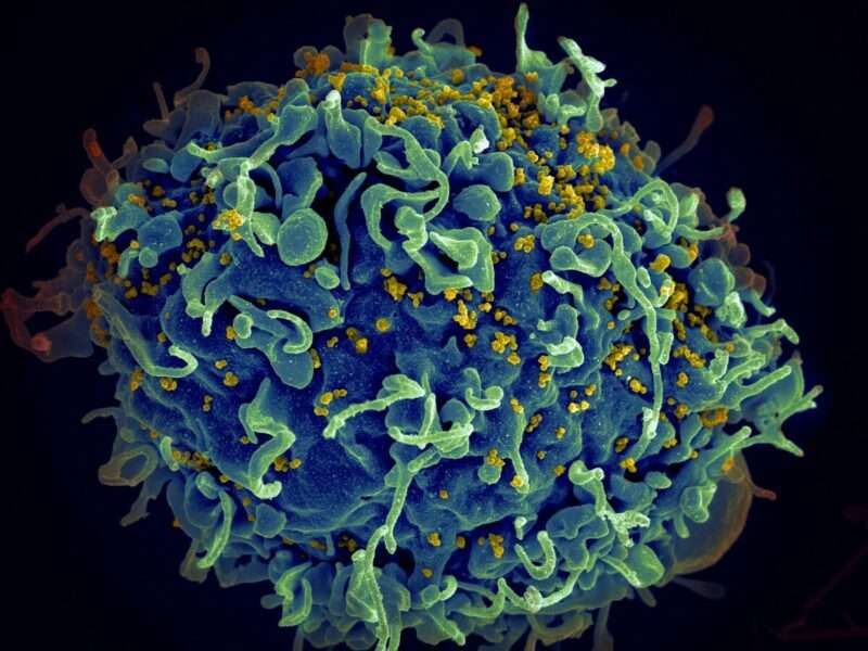 HIV/AIDS: tutto quello che c’è da sapere sull’infezione che colpisce il sistema immunitario