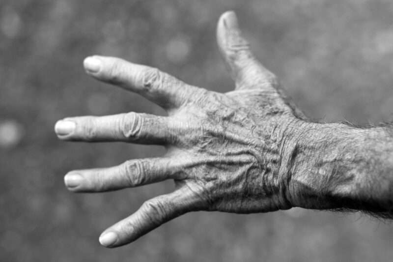 Rughe e invecchiamento: la scienza svela il meccanismo nascosto