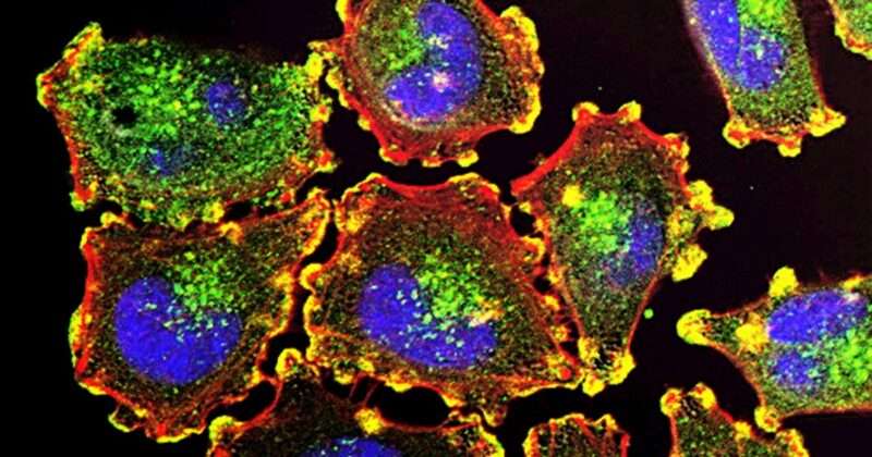 Cancro: i segnali di rischio dall’intestino