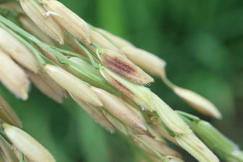 Parkinson: scoperta una possibile origine cerebrale della malattia e un nuovo bersaglio terapeutico