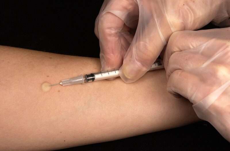 Tubercolosi Resistente: L’Antico Killer che Sfida gli Antibiotici nel 2026