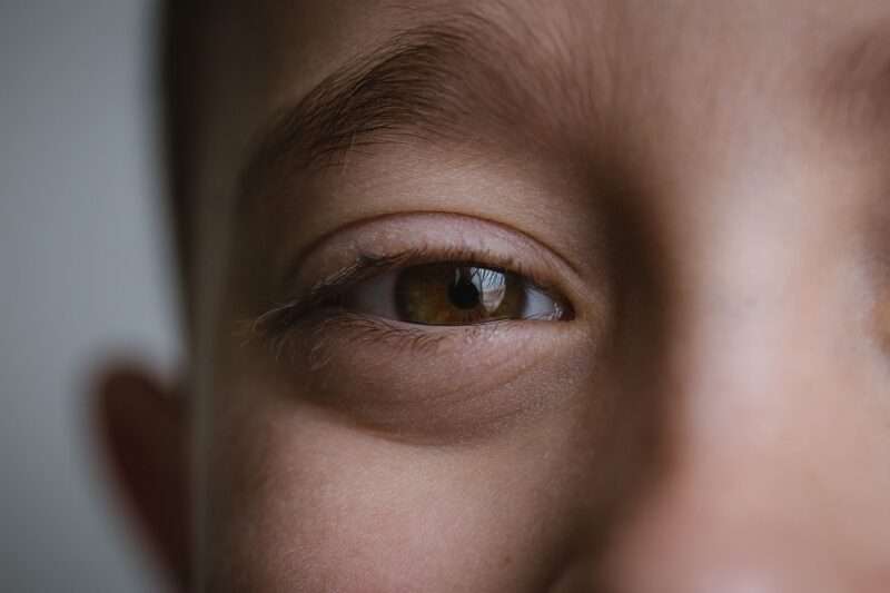 Test Oculistici e Lesioni Cerebrali: La Nuova Diagnosi “Invisibile”