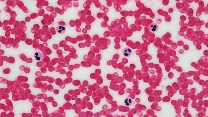 Leucemia Linfatica Cronica: approvato in Italia un nuovo farmaco intelligente